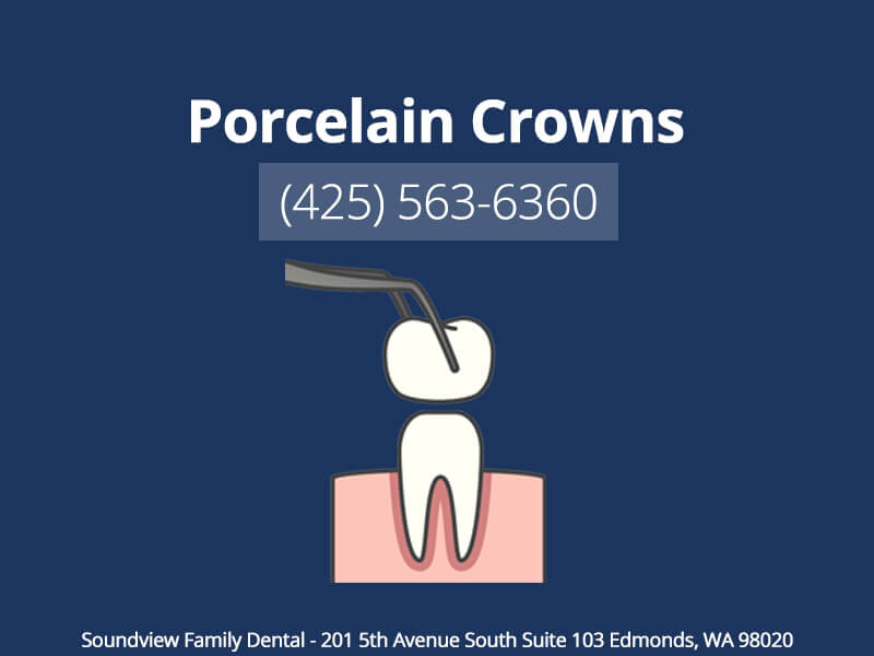 Porcelain Crowns