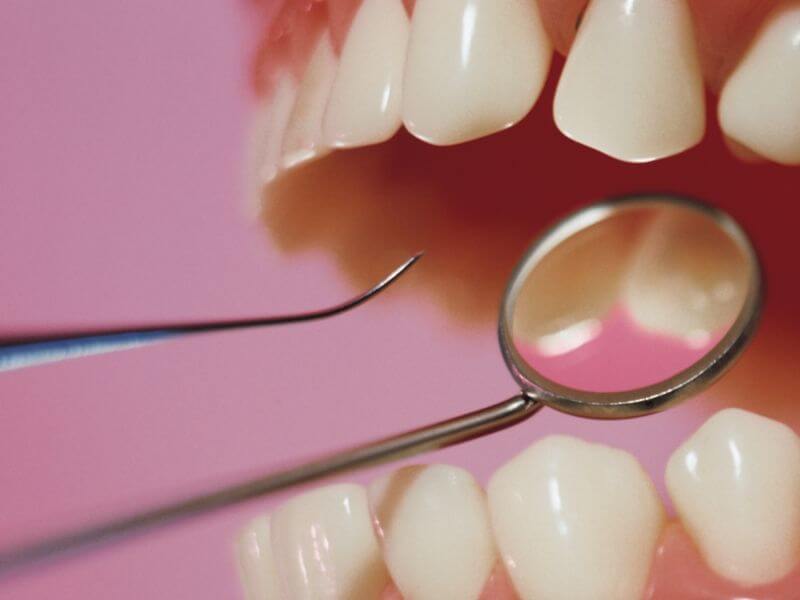 Dental Tools Probing Teeth