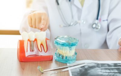 Dental Implant Care After Surgery