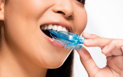 Types of Mouthguards and Their Benefits