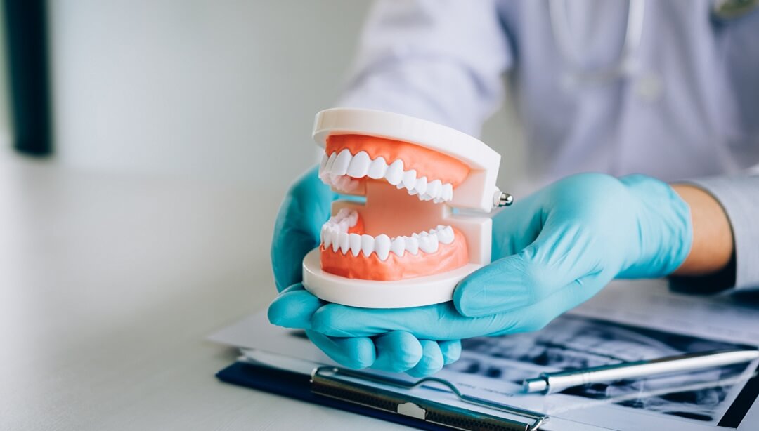 Implant Retained vs. Implant Supported Dentures: Which is Better?