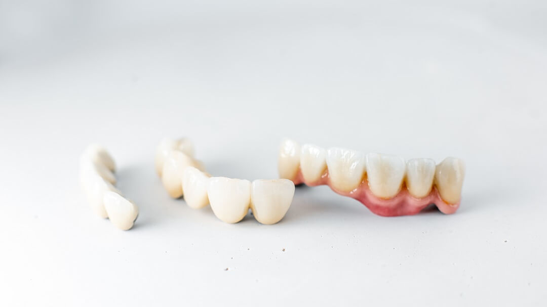 dental crowns on table