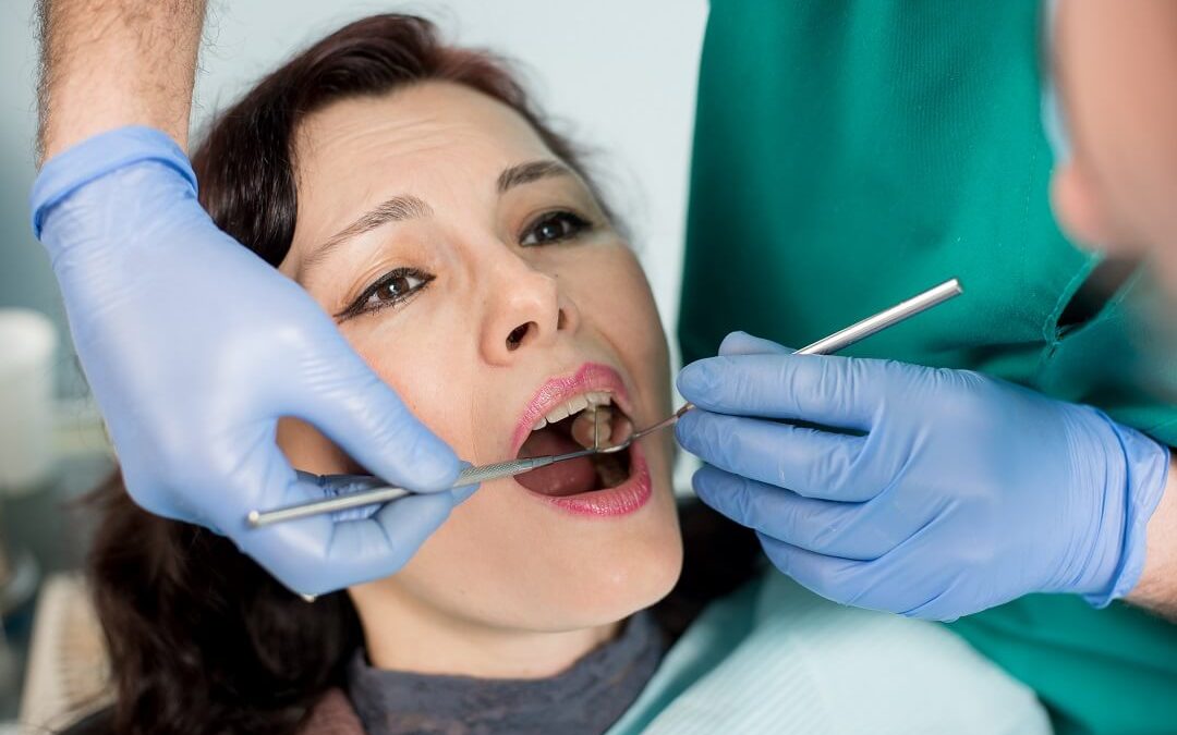 Black Tartar on Teeth: Causes and Treatment