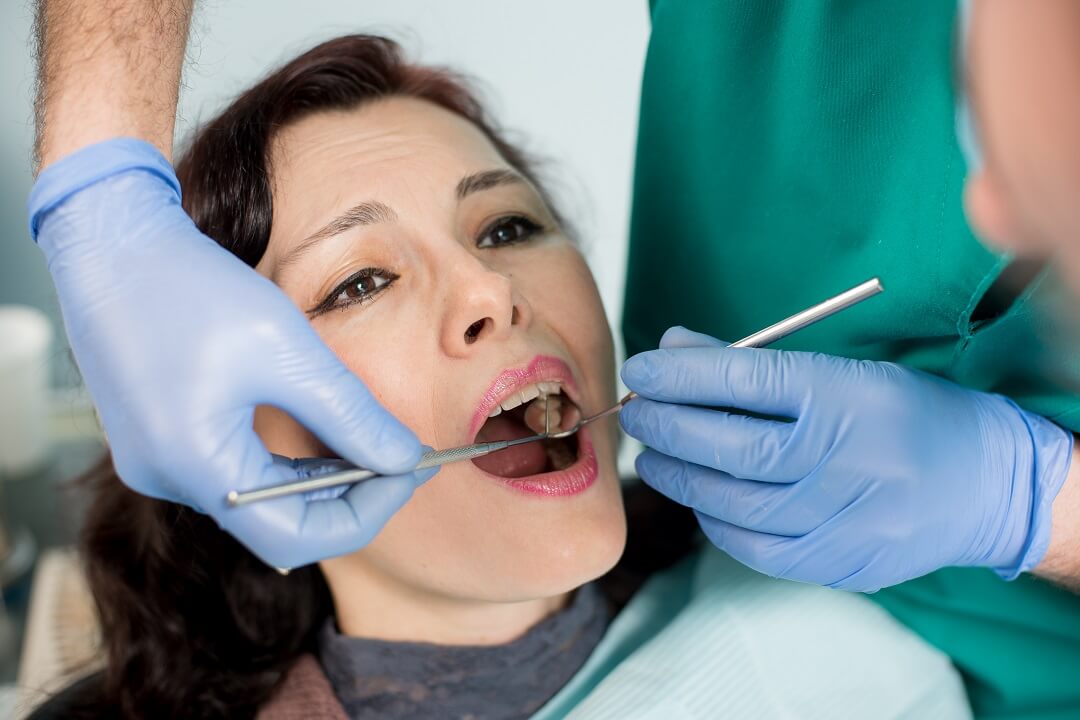 Black Tartar on Teeth: Causes and Treatment
