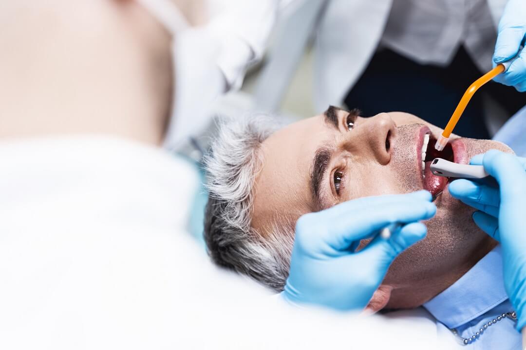 How Long Does a Root Canal Take?