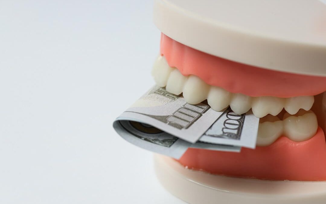 The Cost Factor: Understanding Dental Implant Pricing in Edmonds