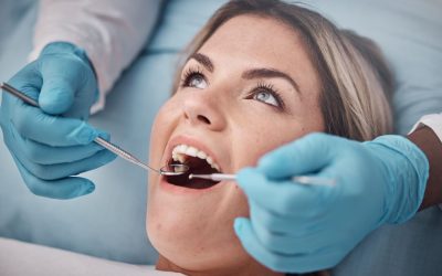 Can Tooth Bonding Fix Cavities?