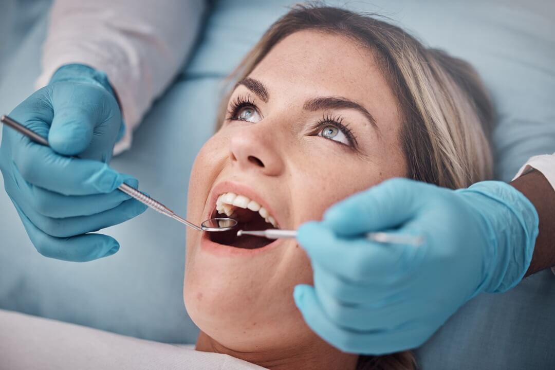 Can Tooth Bonding Fix Cavities?