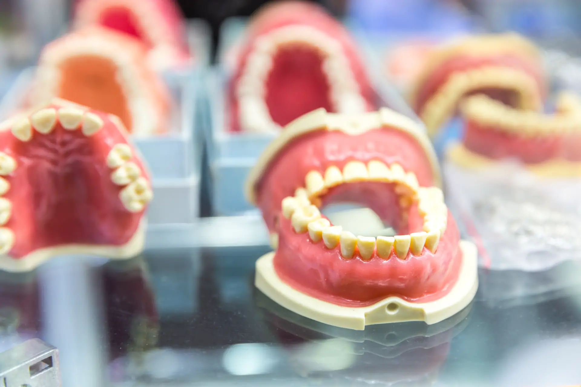 What are Dentures: Your Guide to Types, Benefits, and Care